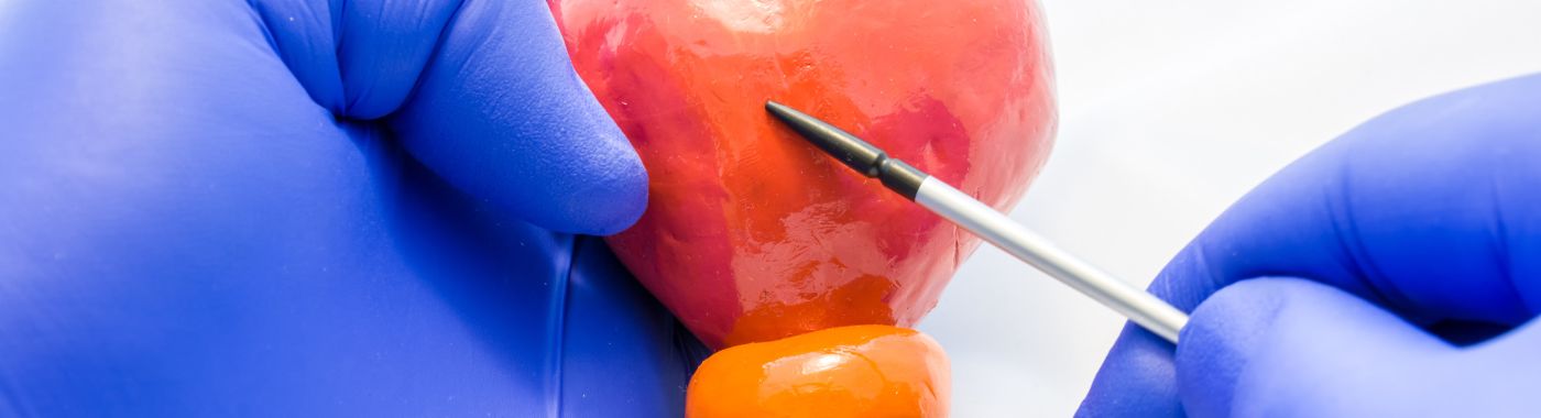 Bladder Exstrophy - Causes, Symptoms, Diagnosis, Treatment, and Prevention