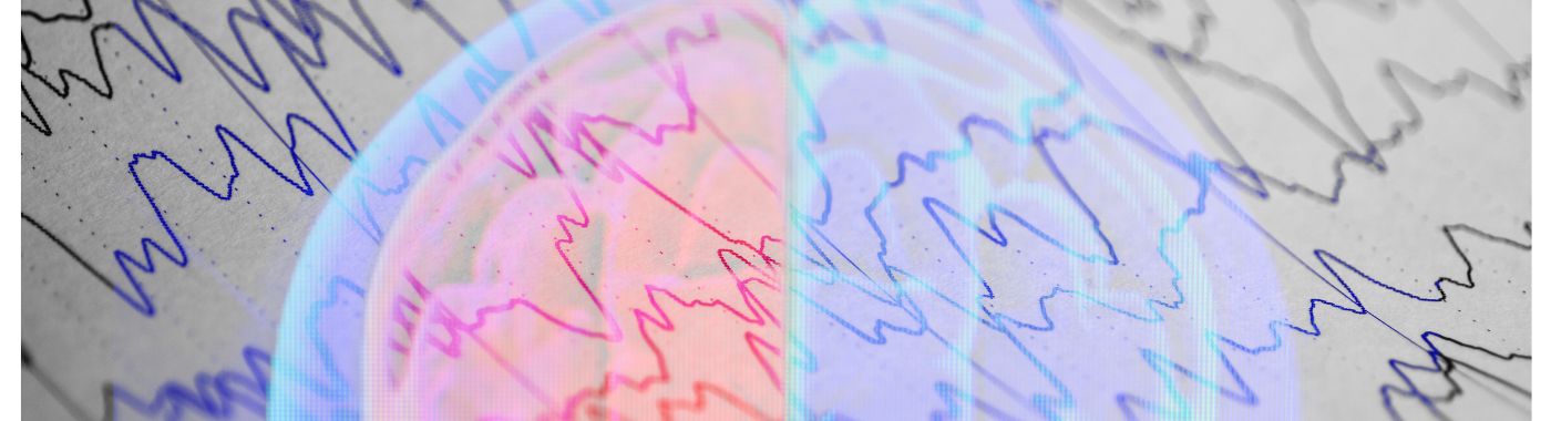 Brain Death - Causes, Symptoms, Diagnosis, Treatment, and Prevention