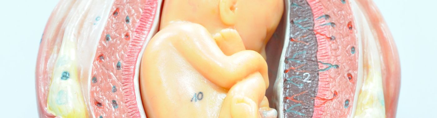 Breech Baby - Causes, Symptoms, Diagnosis, Treatment, and Prevention