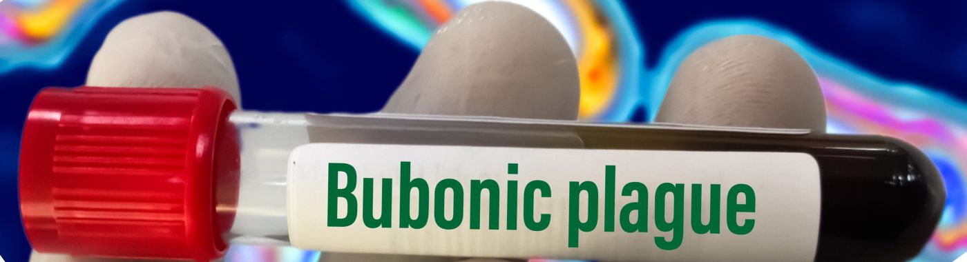 Bubonic Plague - Causes, Symptoms, Diagnosis, Treatment, and Prevention