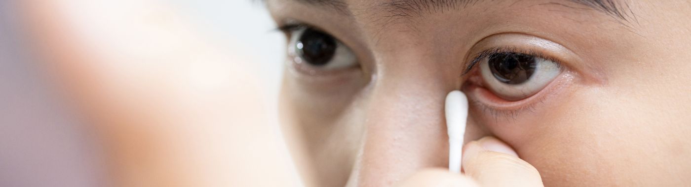 Ectropion - Causes, Symptoms, Diagnosis, Treatment, and Prevention