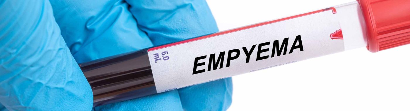 Empyema - Causes, Symptoms, Diagnosis, Treatment, and Prevention
