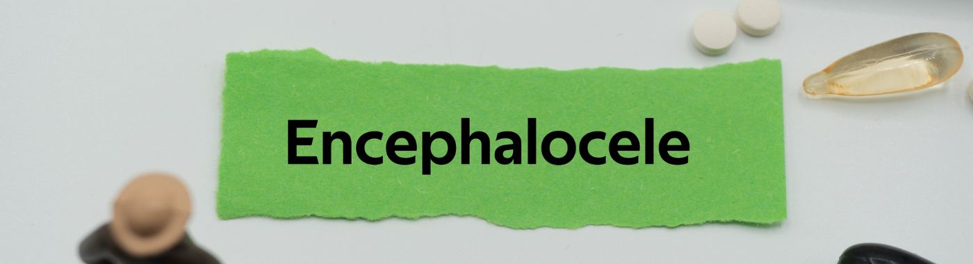 Encephalocele - Causes, Symptoms, Diagnosis, Treatment, and Prevention
