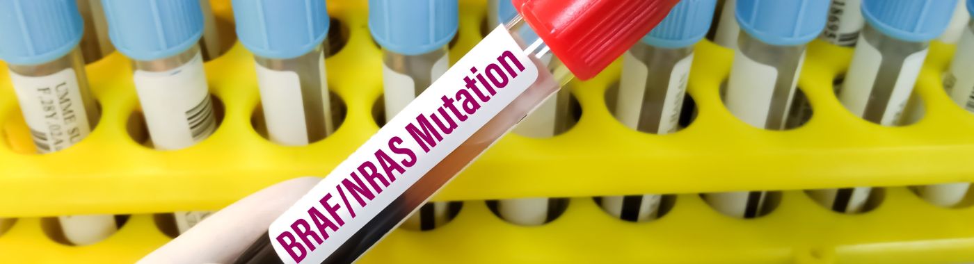 Erdheim Chester Disease - Causes, Symptoms, Diagnosis, Treatment, and Prevention