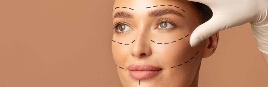 Facelift (Rhytidectomy)