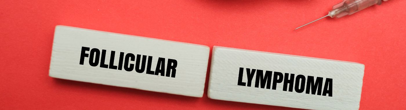 Follicular Lymphoma - Causes, Symptoms, Diagnosis, Treatment, and Prevention