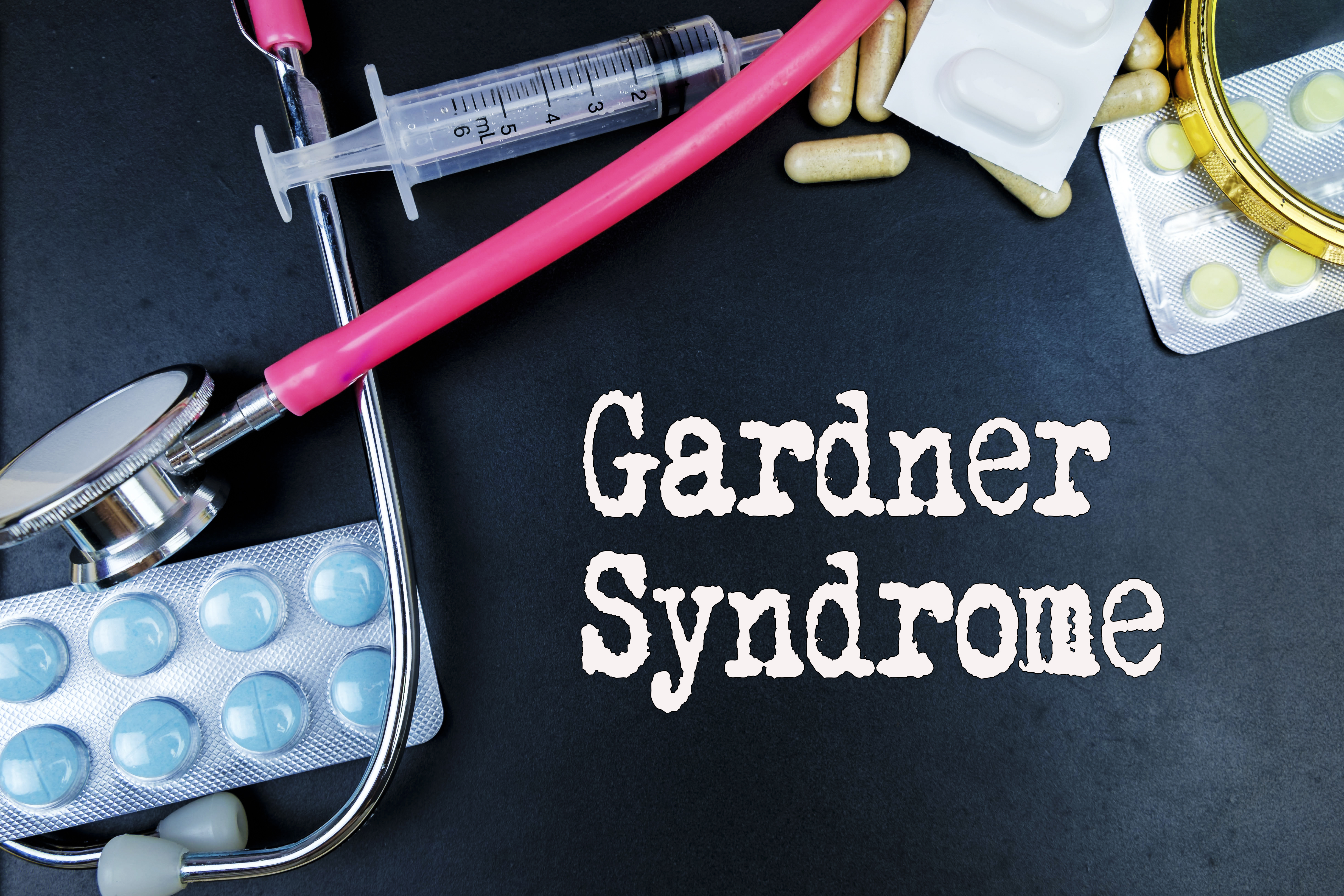 Gardner Syndrome - Causes, Symptoms, Diagnosis, Treatment, and Prevention