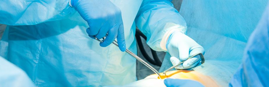 GI Oncologic Surgery