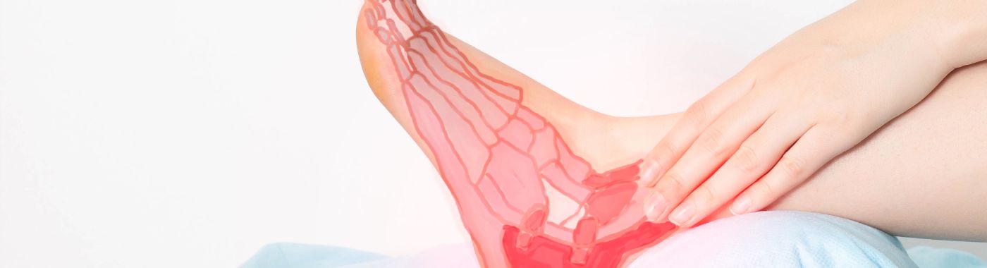 Heel Spurs - Causes, Symptoms, Diagnosis, Treatment, and Prevention