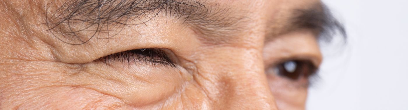 Hemifacial Spasm - Causes, Symptoms, Diagnosis, Treatment, and Prevention