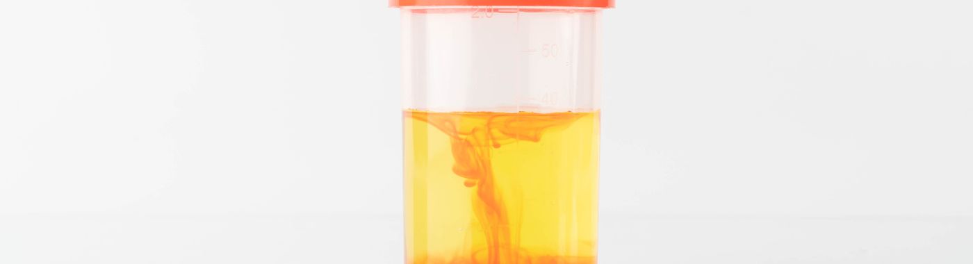 Hemolytic Uremic Syndrome - Causes, Symptoms, Diagnosis, Treatment, and Prevention