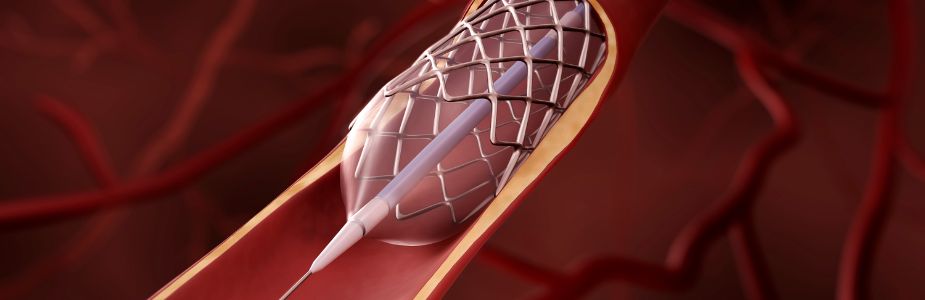 Stenting in Biliary / GI Strictures