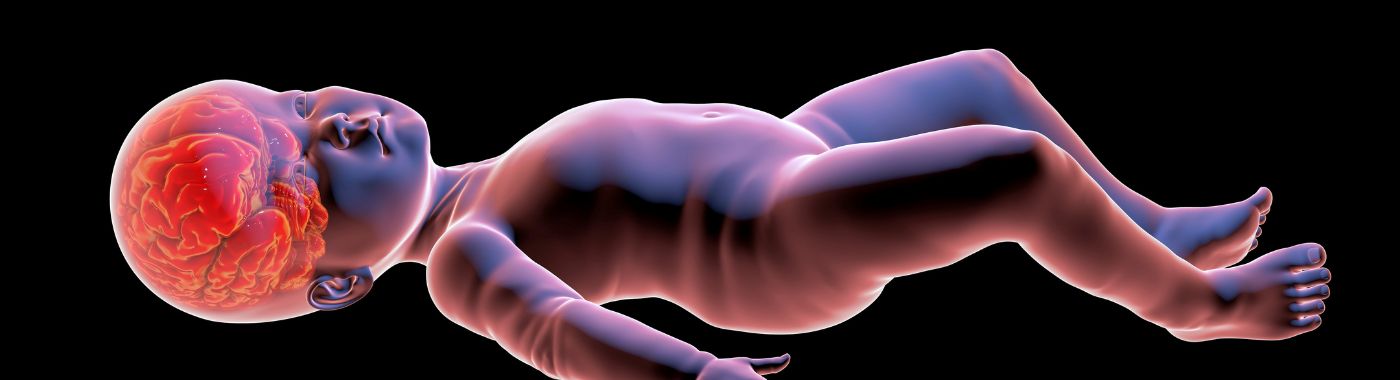 Weaver Syndrome - Causes, Symptoms, Diagnosis, Treatment, and Prevention