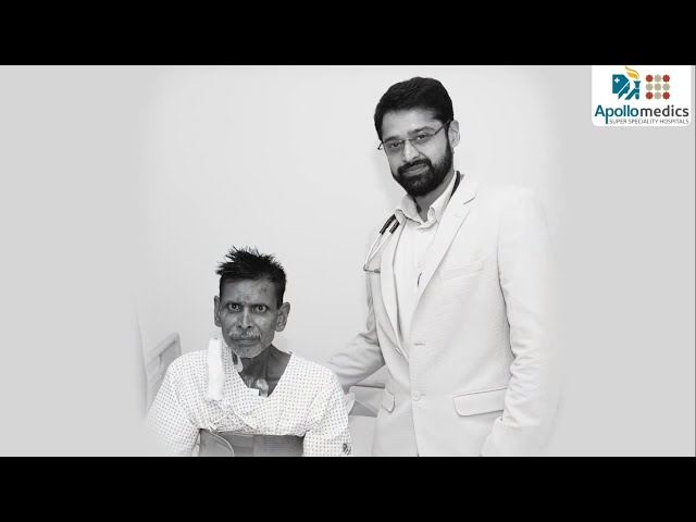 15% हार्ट फंक्शन पर भी हुई जटिल वाल्व रिप्लेसमेंट सर्जरी