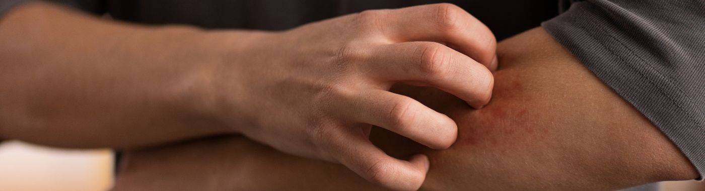 Basophilia - Causes, Symptoms, Diagnosis, Treatment, and Prevention