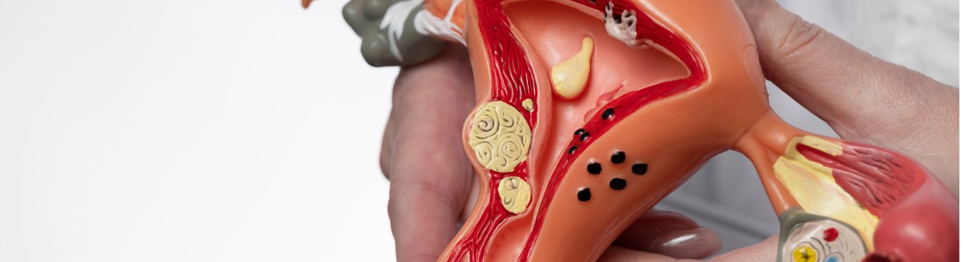 Bicornuate Uterus - Causes, Symptoms, Diagnosis, Treatment, and Prevention