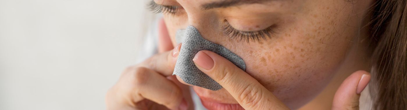 Blackheads - Causes, Symptoms, Diagnosis, Treatment, and Prevention