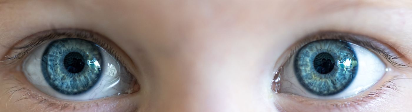 Buphthalmos - Causes, Symptoms, Diagnosis, Treatment, and Prevention