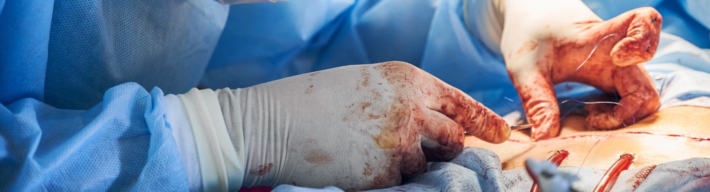 Coronary Bypass Surgery in India