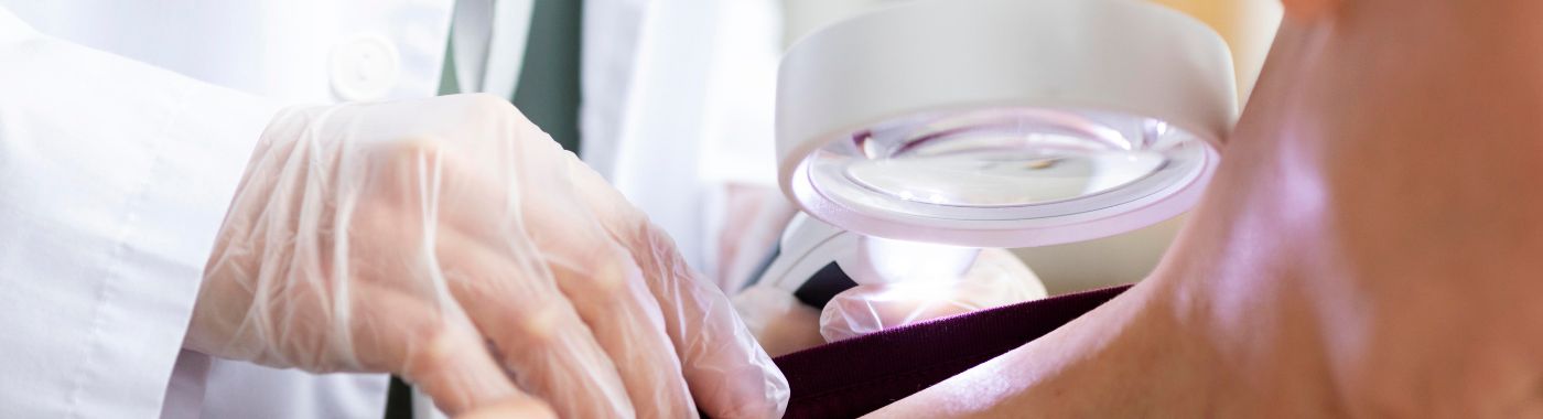 Dermoid Cyst - Causes, Symptoms, Diagnosis, Treatment, and Prevention