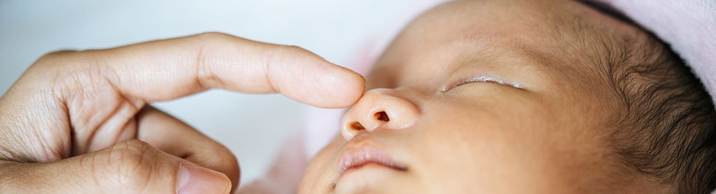 Galactosemia - Causes, Symptoms, Diagnosis, Treatment, and Prevention