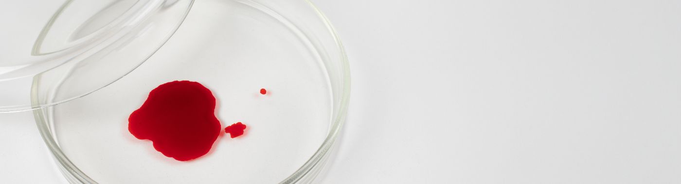 Hemophilia A - Causes, Symptoms, Diagnosis, Treatment, and Prevention