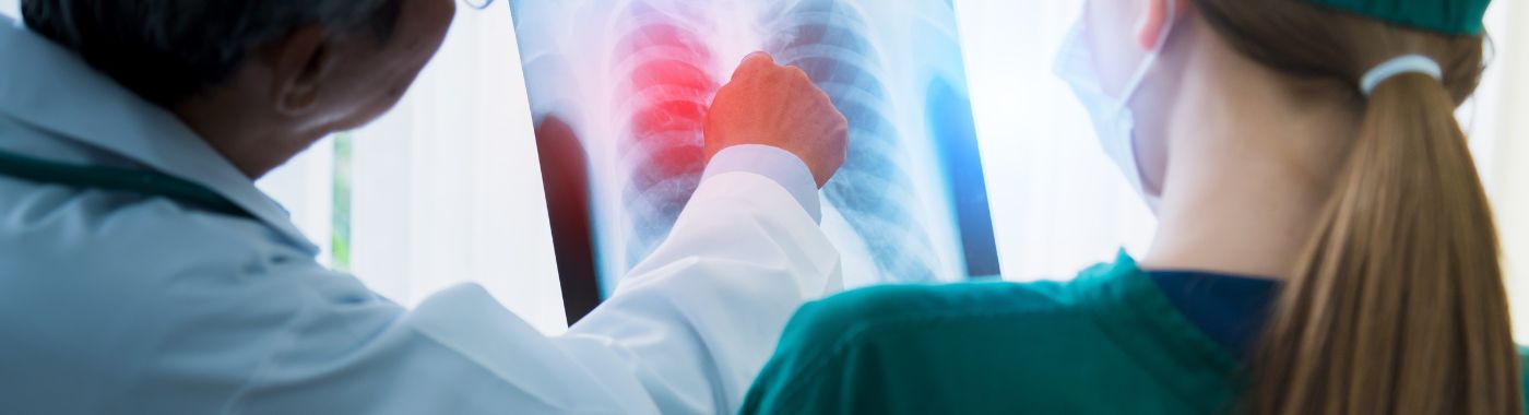 Hemothorax - Causes, Symptoms, Diagnosis, Treatment, and Prevention