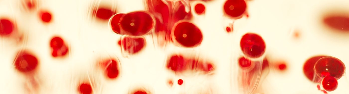 Hereditary Spherocytosis - Causes, Symptoms, Diagnosis, Treatment, and Prevention