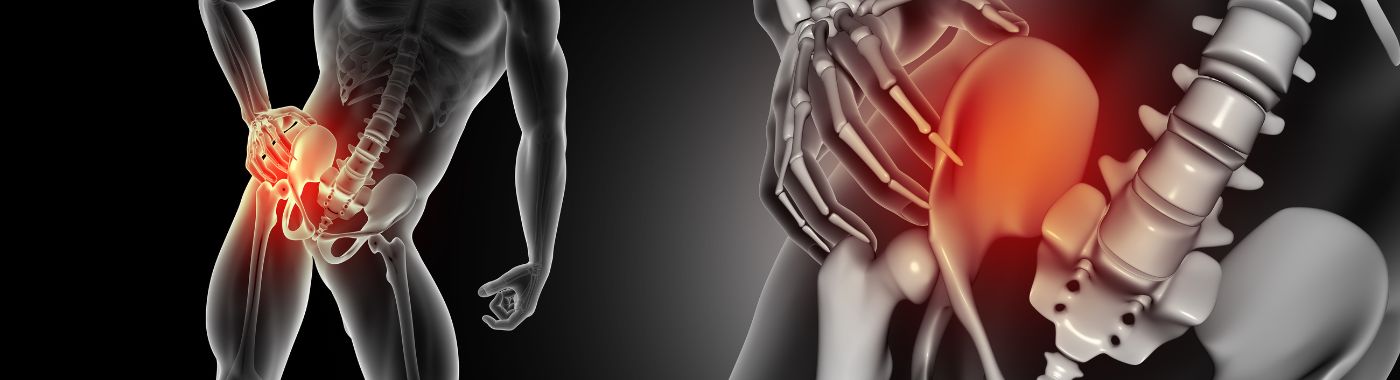 Hip Dislocation - Causes, Symptoms, Diagnosis, Treatment, and Prevention