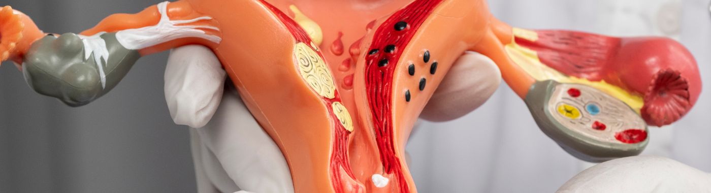 Hydrosalpinx - Causes, Symptoms, Diagnosis, Treatment, and Prevention