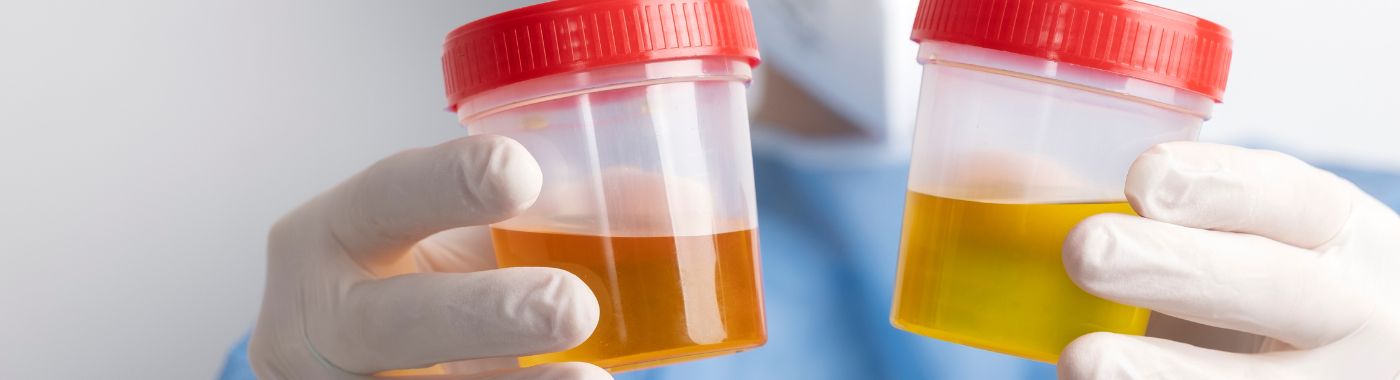 Hyperparathyroidism - Causes, Symptoms, Diagnosis, Treatment, and Prevention