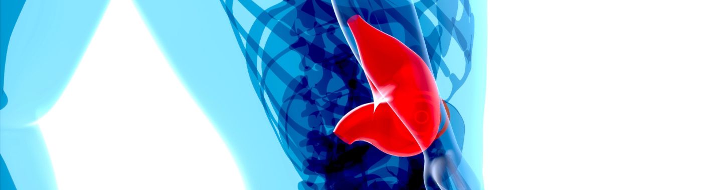 Hypersplenism - Causes, Symptoms, Diagnosis, Treatment, and Prevention