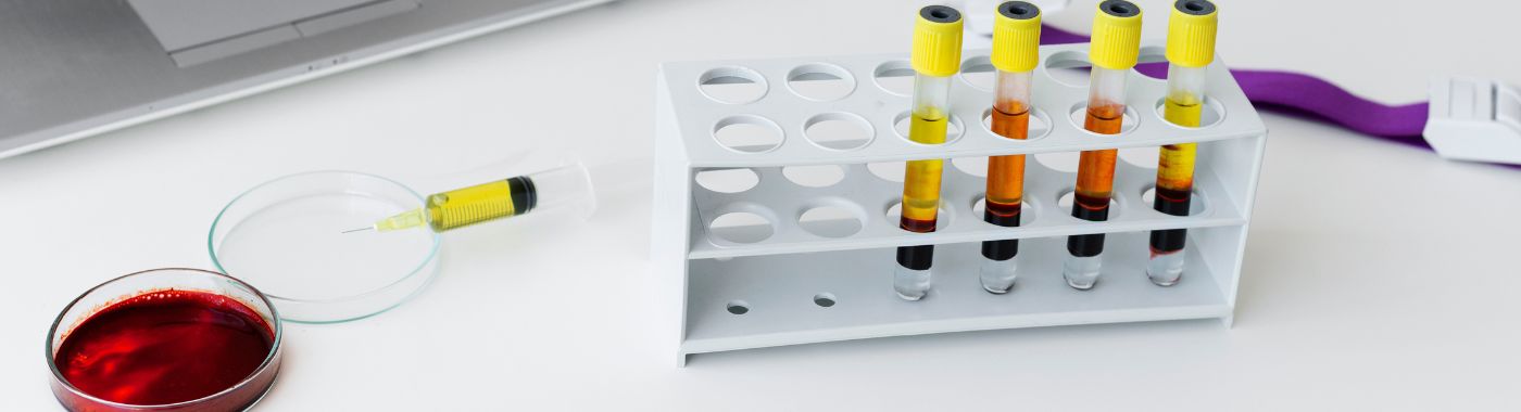 Hyperviscosity Syndrome - Causes, Symptoms, Diagnosis, Treatment, and Prevention