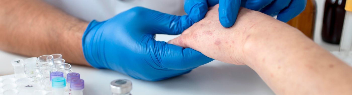 Hypoxemia - Causes, Symptoms, Diagnosis, Treatment, and Prevention