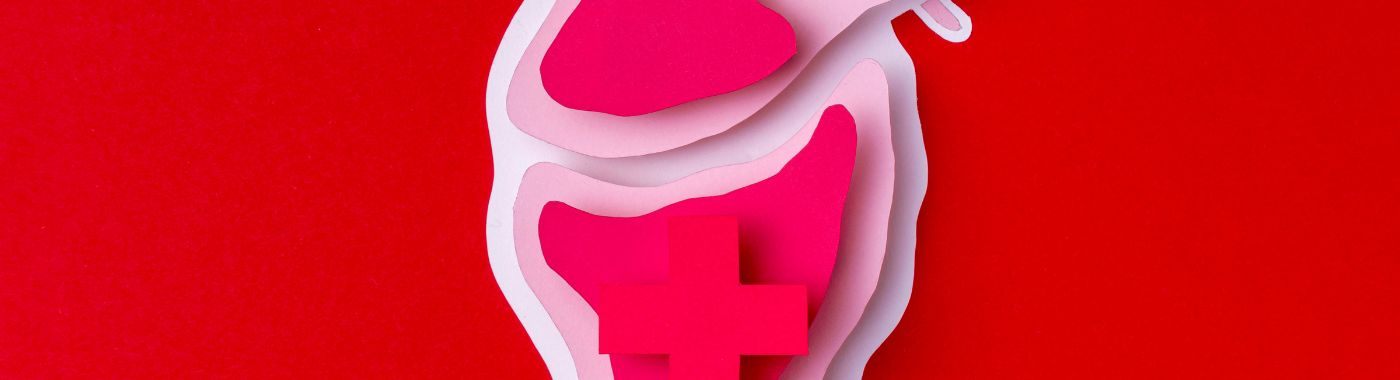 Left Bundle Branch Block - Causes, Symptoms, Diagnosis, Treatment, and Prevention