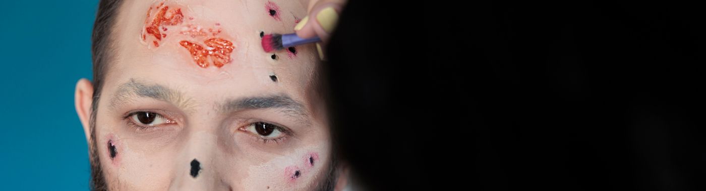 Lichen Sclerosus - Causes, Symptoms, Diagnosis, Treatment, and Prevention