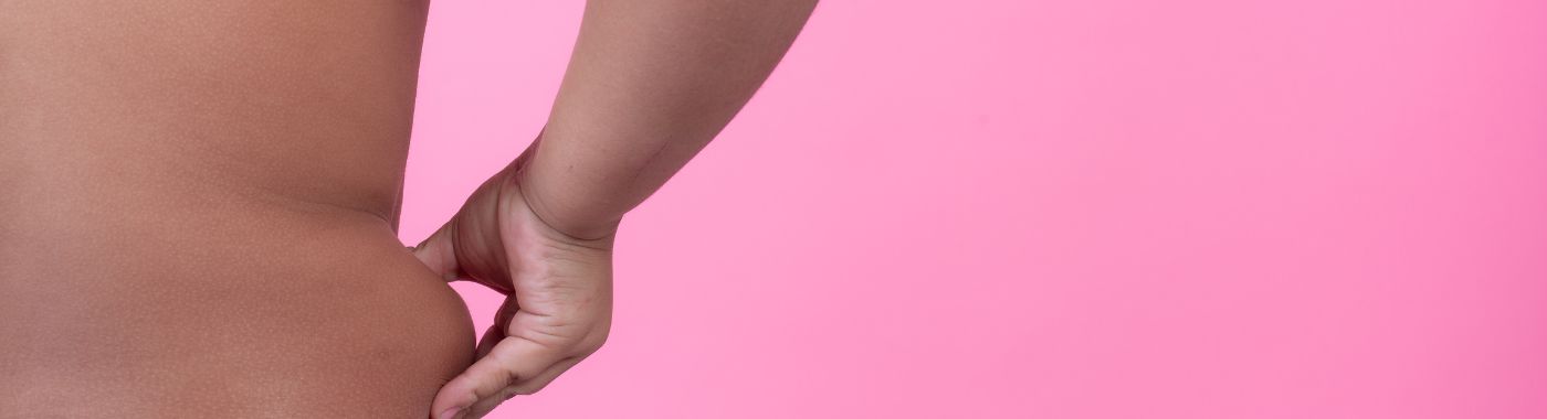 Lipodystrophy - Causes, Symptoms, Diagnosis, Treatment, and Prevention