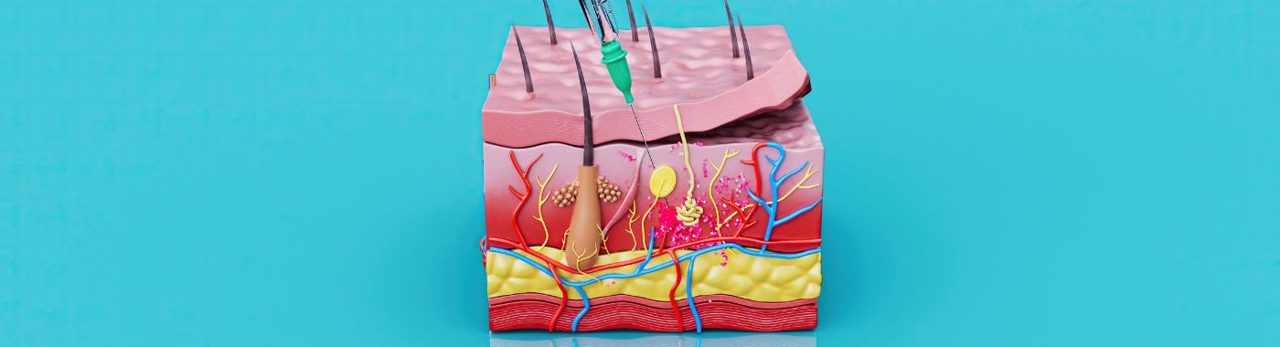 Lipohypertrophy - Causes, Symptoms, Diagnosis, Treatment, and Prevention