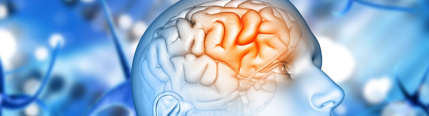 Lissencephaly - Causes, Symptoms, Diagnosis, Treatment, and Prevention