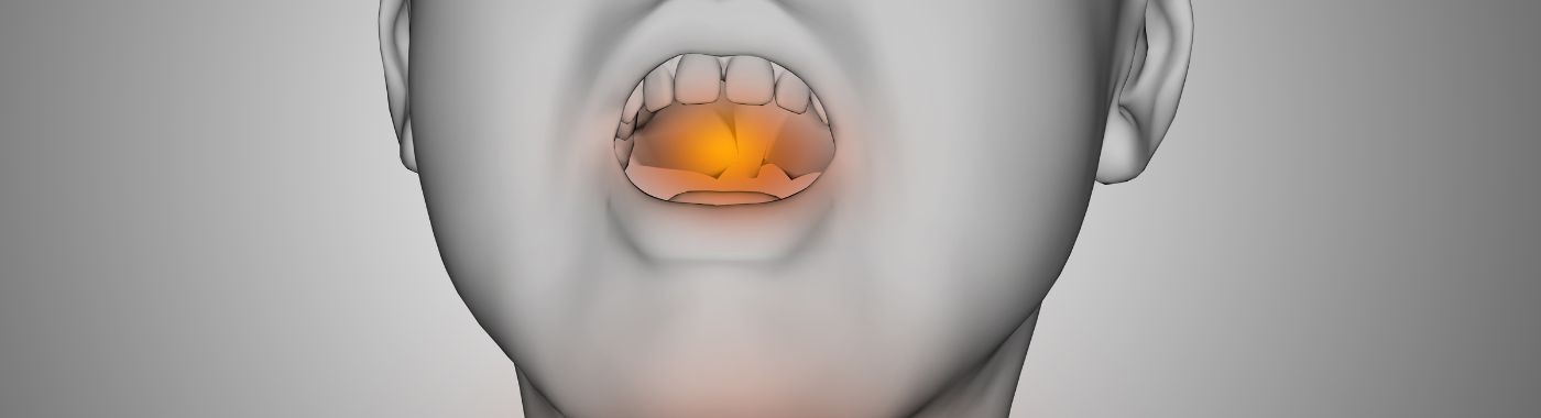 Ludwigs Angina - Causes, Symptoms, Diagnosis, Treatment, and Prevention