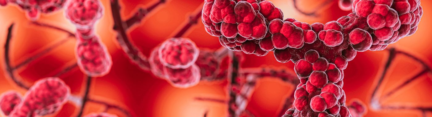 Lymphopenia - Causes, Symptoms, Diagnosis, Treatment, and Prevention