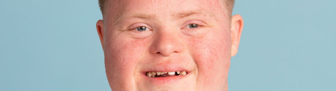 Macrocephaly - Causes, Symptoms, Diagnosis, Treatment, and Prevention