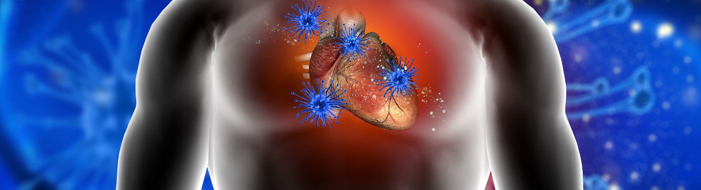 Mediastinitis - Causes, Symptoms, Diagnosis, Treatment, and Prevention