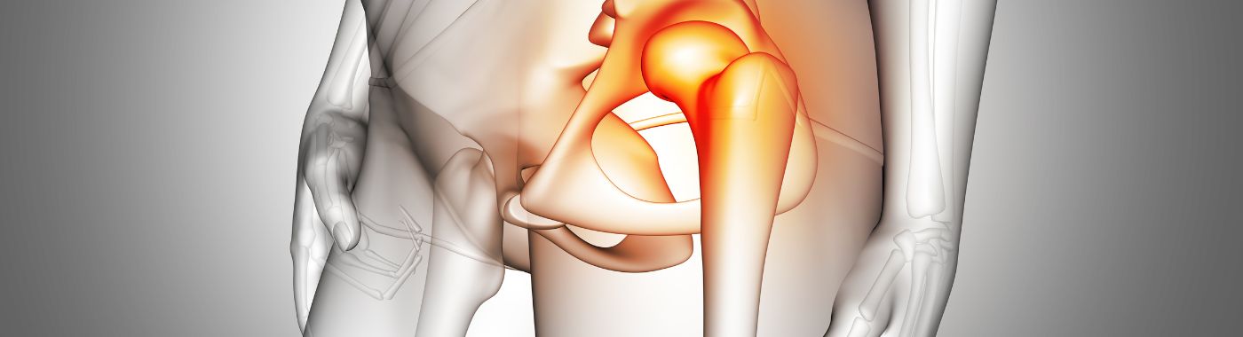 Meralgia Paresthetica - Causes, Symptoms, Diagnosis, Treatment, and Prevention