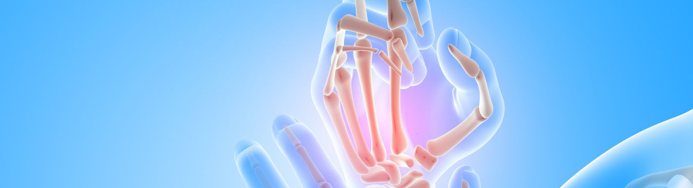 Metacarpal Fracture - Causes, Symptoms, Diagnosis, Treatment, and Prevention
