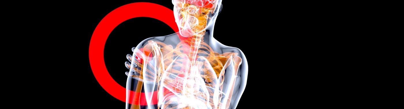 Myotonia - Causes, Symptoms, Diagnosis, Treatment, and Prevention