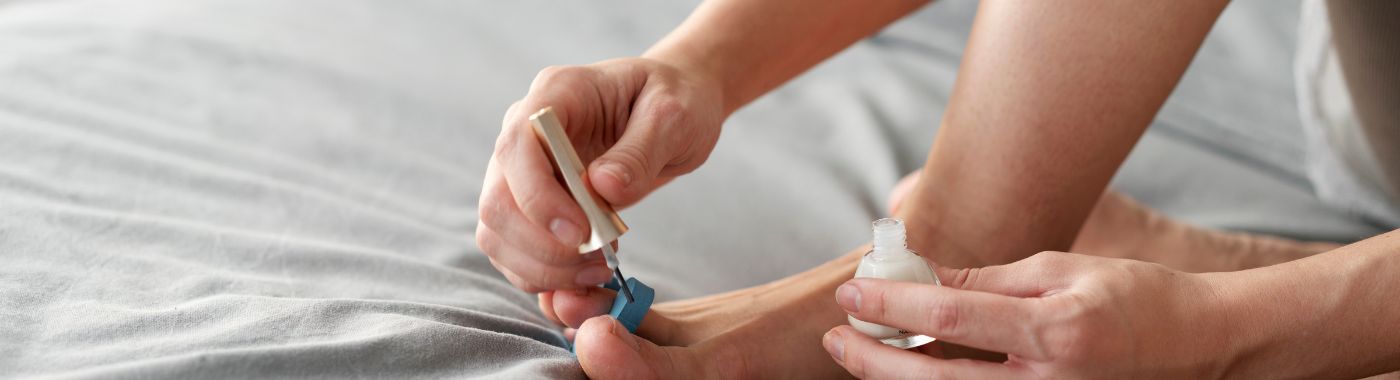 Nail Psoriasis - Causes, Symptoms, Diagnosis, Treatment, and Prevention