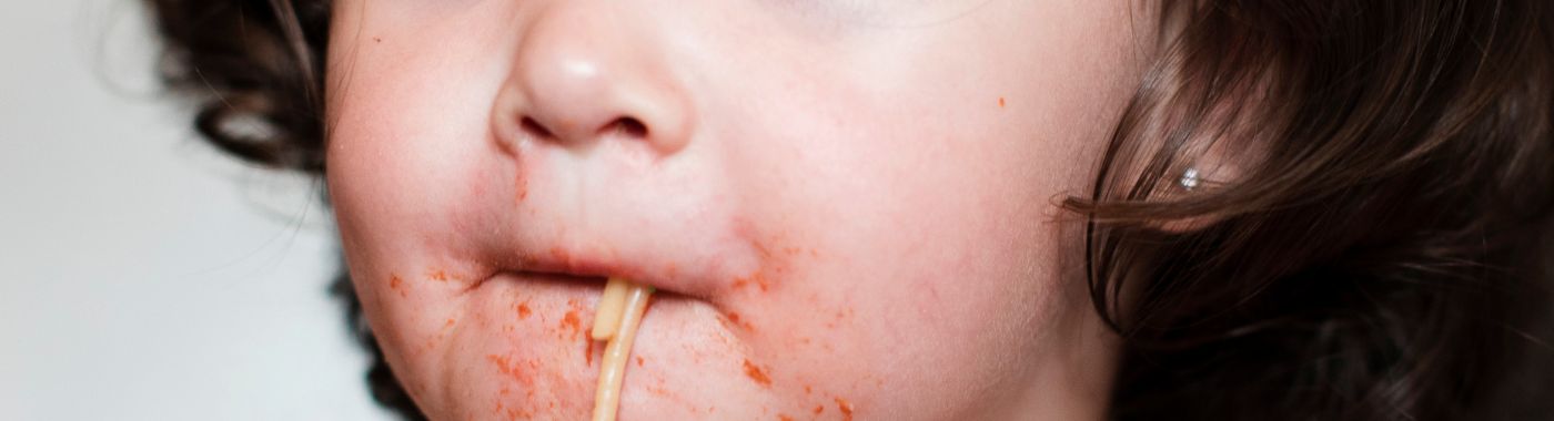 Neonatal Herpes Simplex - Causes, Symptoms, Diagnosis, Treatment, and Prevention