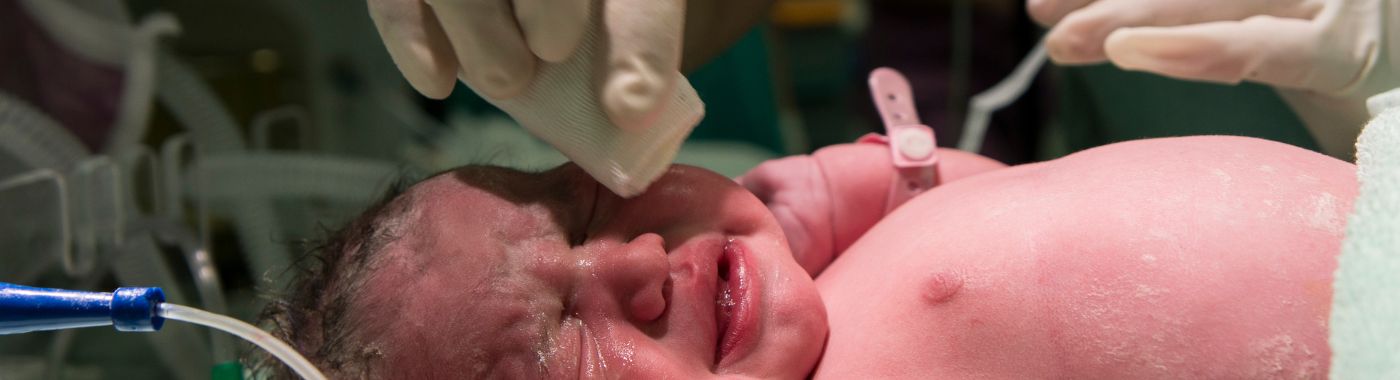 Neonatal Lupus - Causes, Symptoms, Diagnosis, Treatment, and Prevention