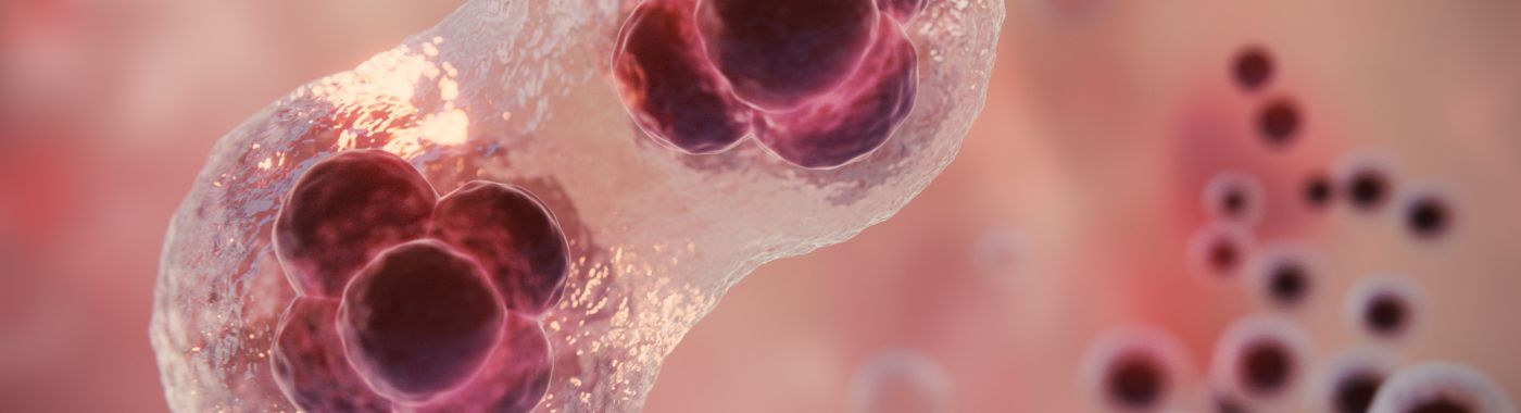 Neutrophilia - Causes, Symptoms, Diagnosis, Treatment, and Prevention